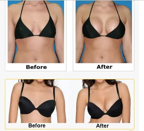 breast growth products 500x500 1